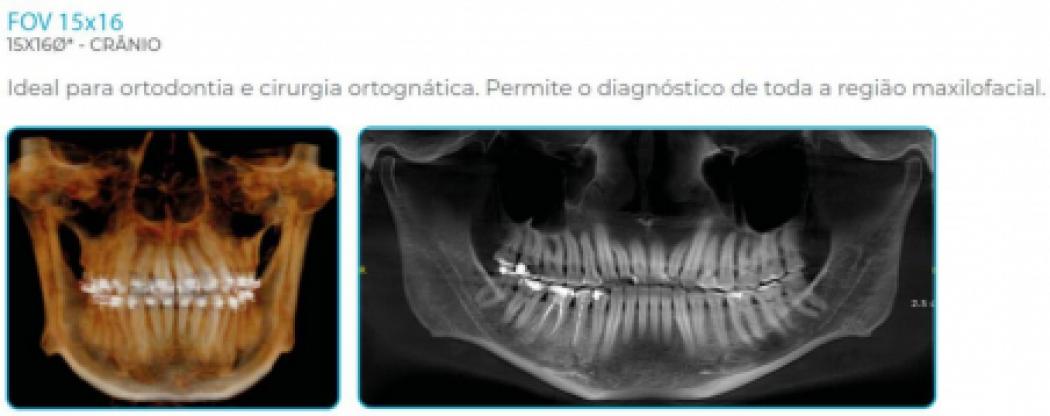 Eagle Edge Linha Pro - Dabi Atlante