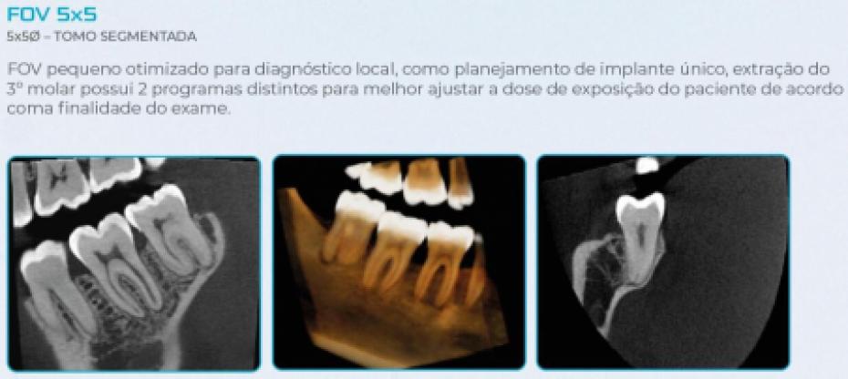 Eagle Edge Linha One - Dabi Atlante