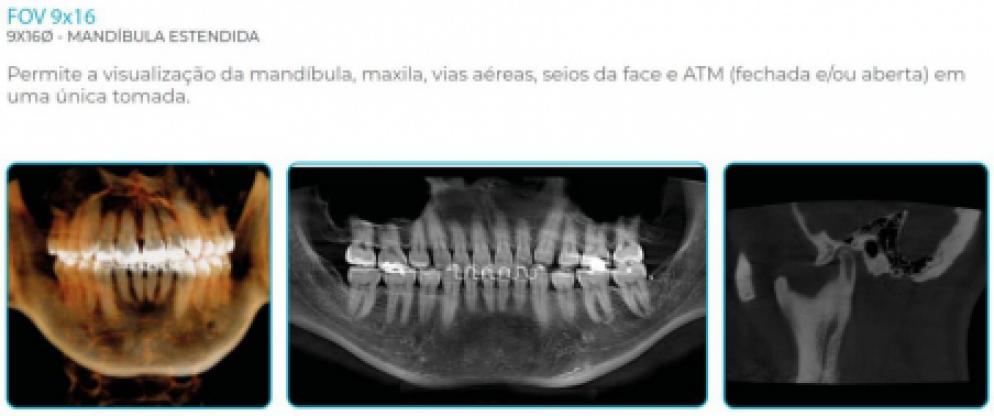 Eagle Edge Linha Pro - Dabi Atlante