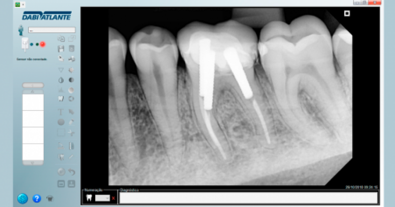Eagle S T1 - Dabi Atlante