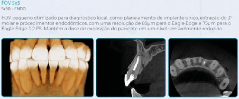 Eagle Edge 0.2 FS Linha Pro - Dabi Atlante